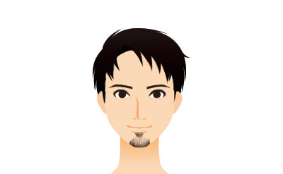 ヒゲ脱毛のあごヒゲタイプ