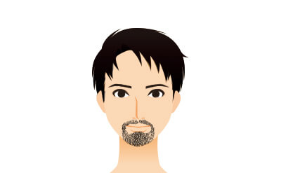 ヒゲ脱毛のかこみタイプ