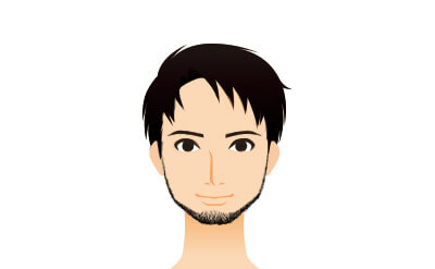 ヒゲ脱毛のリンカニックタイプ