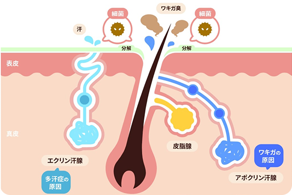 ワキガの元である汗の作られ方イメージ画像