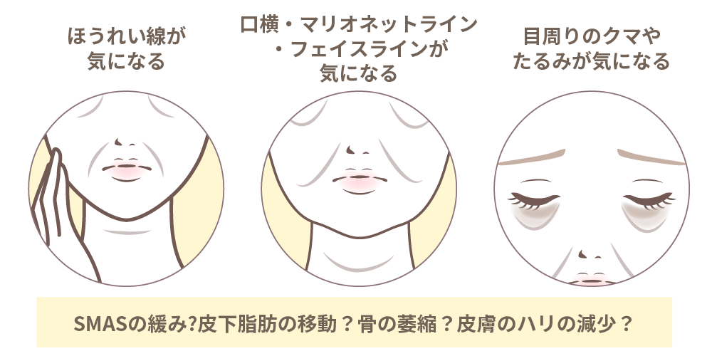 たるみの種類のイメージ画像