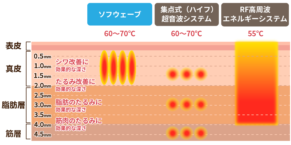 皮膚の構造の画像