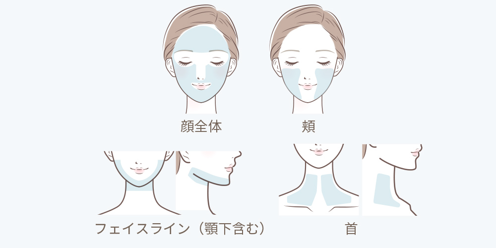 照射範囲の詳細画像