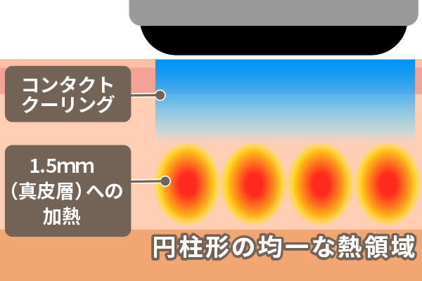 ソフウェーブの仕組みの詳細画像