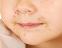 診療メニュー一覧 坂戸市にっさい花みず木 診療メニュー一覧 坂戸市にっさい花みず木